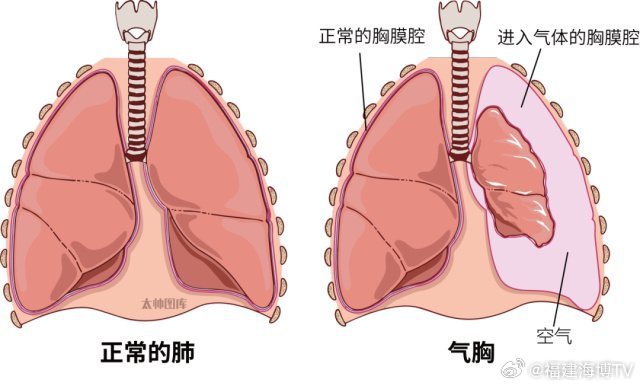 揭秘爆肺真相，一探究竟！